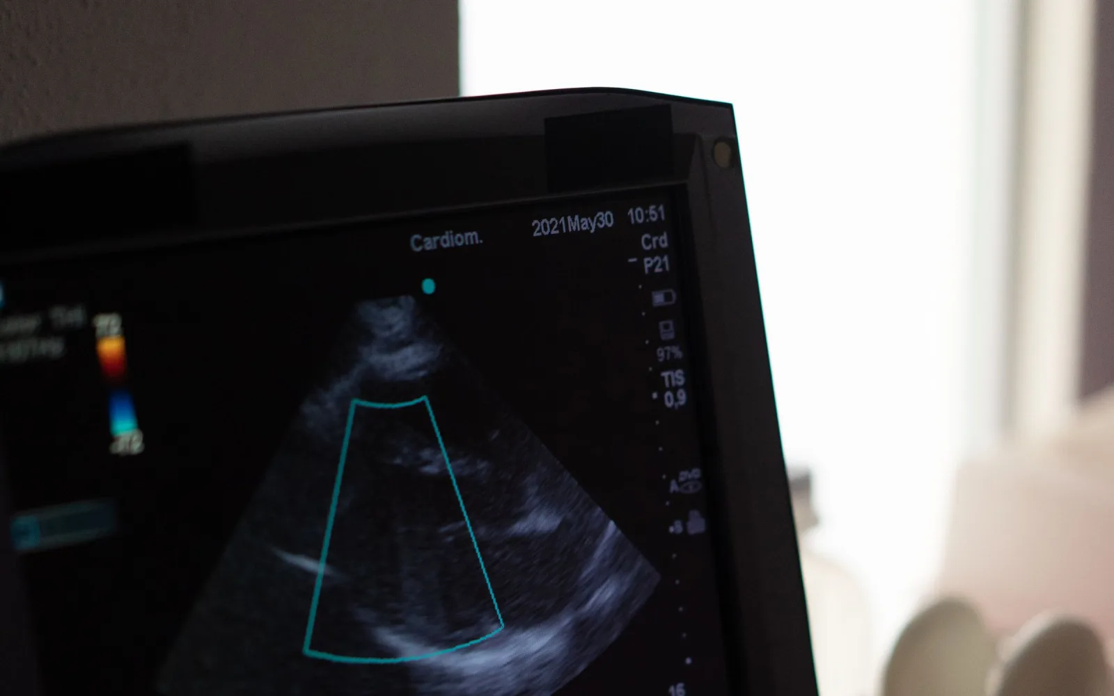 Echocardiography image of the heart on an ultrasound screen