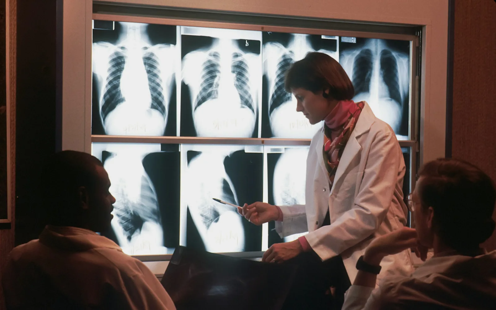Radiologist reviewing chest X-rays with colleagues