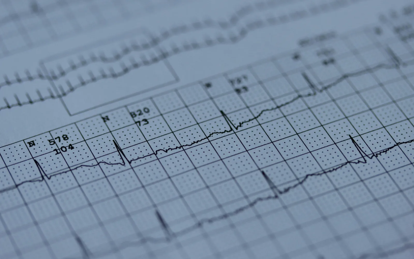 ECG trace on electrocardiogram paper
